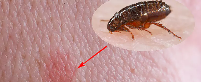 Flea Control for Humans Grand Prairie, TX